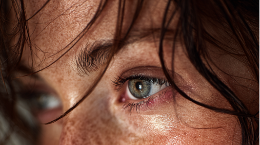 Stye on eye. 